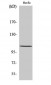 Histone deacetylase 7a Polyclonal Antibody