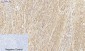 HSP27 Polyclonal Antibody