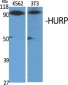 HURP Polyclonal Antibody