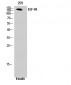 IGF-IR Polyclonal Antibody