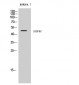 IGSF4C Polyclonal Antibody