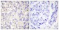 IKKβ Polyclonal Antibody