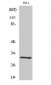 IL-1β Polyclonal Antibody