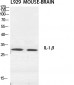 IL-1β Polyclonal Antibody