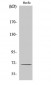 Involucrin Polyclonal Antibody