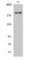 IRS-1 Polyclonal Antibody