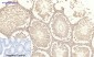 IRS-1 Polyclonal Antibody