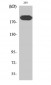 IRS-1 Polyclonal Antibody