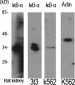 IκB-α Polyclonal Antibody