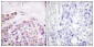IκB-ε Polyclonal Antibody