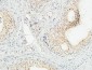 JAB1 Polyclonal Antibody