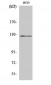 JAK2 Polyclonal Antibody