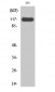 JAK2 Polyclonal Antibody