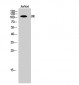 JIK Polyclonal Antibody