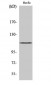 KCNH1 Polyclonal Antibody