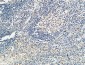 KiSS-1R Polyclonal Antibody