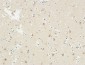 KiSS-1R Polyclonal Antibody