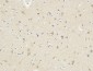 KiSS-1R Polyclonal Antibody