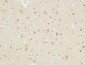 KiSS-1R Polyclonal Antibody