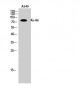 Ku-86 Polyclonal Antibody