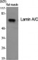 Lamin A/C Polyclonal Antibody