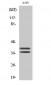 LAT Polyclonal Antibody