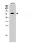 Lck Polyclonal Antibody