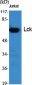 Lck Polyclonal Antibody