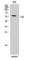 Lck Polyclonal Antibody