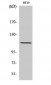 Lfc Polyclonal Antibody