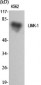 LIMK-1 Polyclonal Antibody