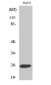 LT-β Polyclonal Antibody