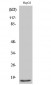 Mammaglobin B Polyclonal Antibody