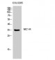 MC1-R Polyclonal Antibody