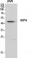 MCT4 Polyclonal Antibody