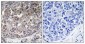 MDA5 Polyclonal Antibody