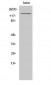 MDA5 Polyclonal Antibody