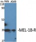 MEL-1B-R Polyclonal Antibody
