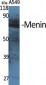 Menin Polyclonal Antibody