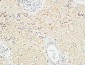 Met Polyclonal Antibody