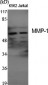MMP-1 Polyclonal Antibody