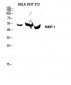 MMP-1 Polyclonal Antibody