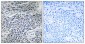MMP-11 Polyclonal Antibody