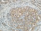 MMP-13 Polyclonal Antibody