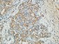 MMP-13 Polyclonal Antibody