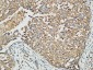 MMP-13 Polyclonal Antibody