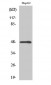 MMP-13 Polyclonal Antibody