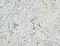 MMP-2 Polyclonal Antibody