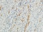 MMP-2 Polyclonal Antibody