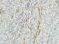 MMP-2 Polyclonal Antibody